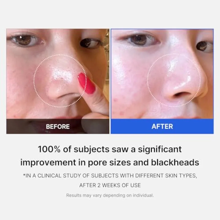 Zero Pore Pads