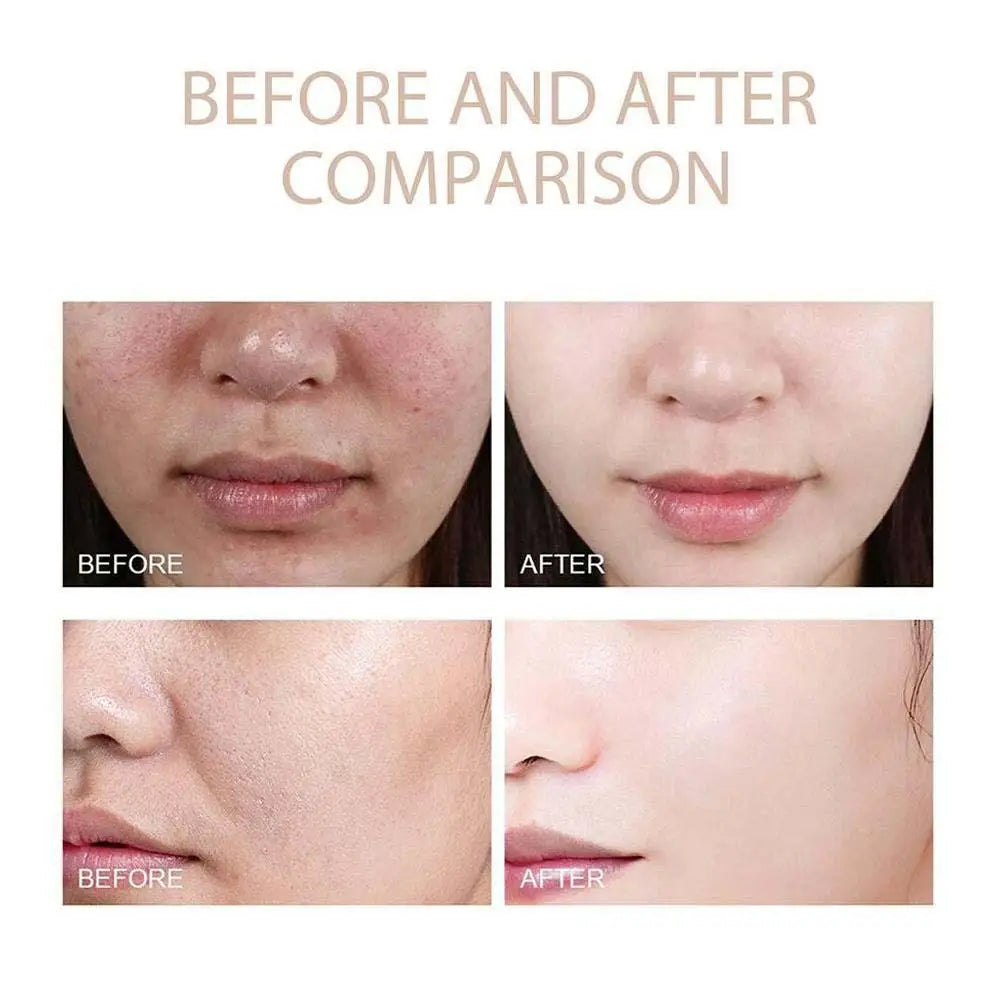 Rice White And Black Soften Serum
